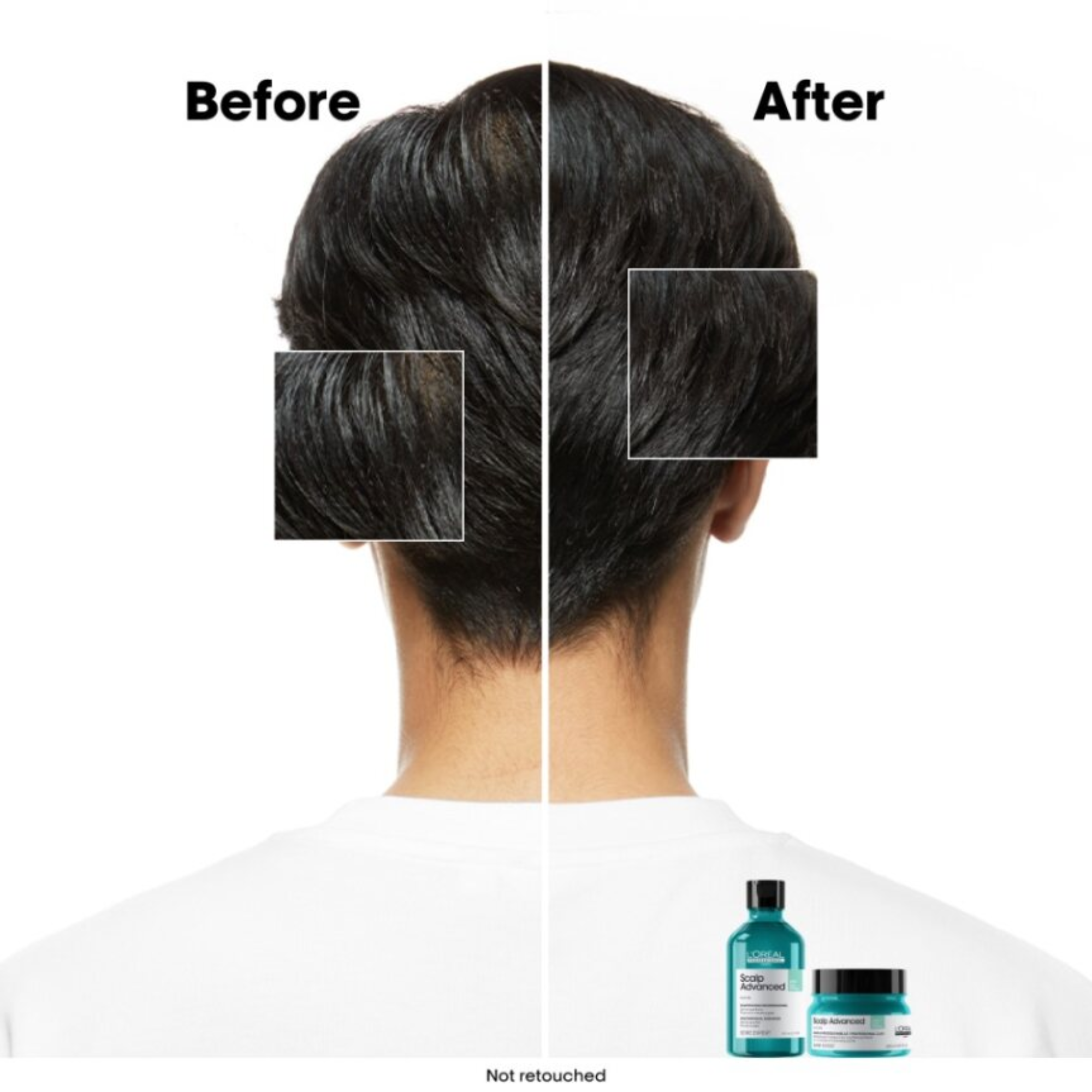 L'Oreal Professional Serie Expert Scalp Advanced Anti-Oiliness 2-in-1 Deep Purifier Clay 250ml