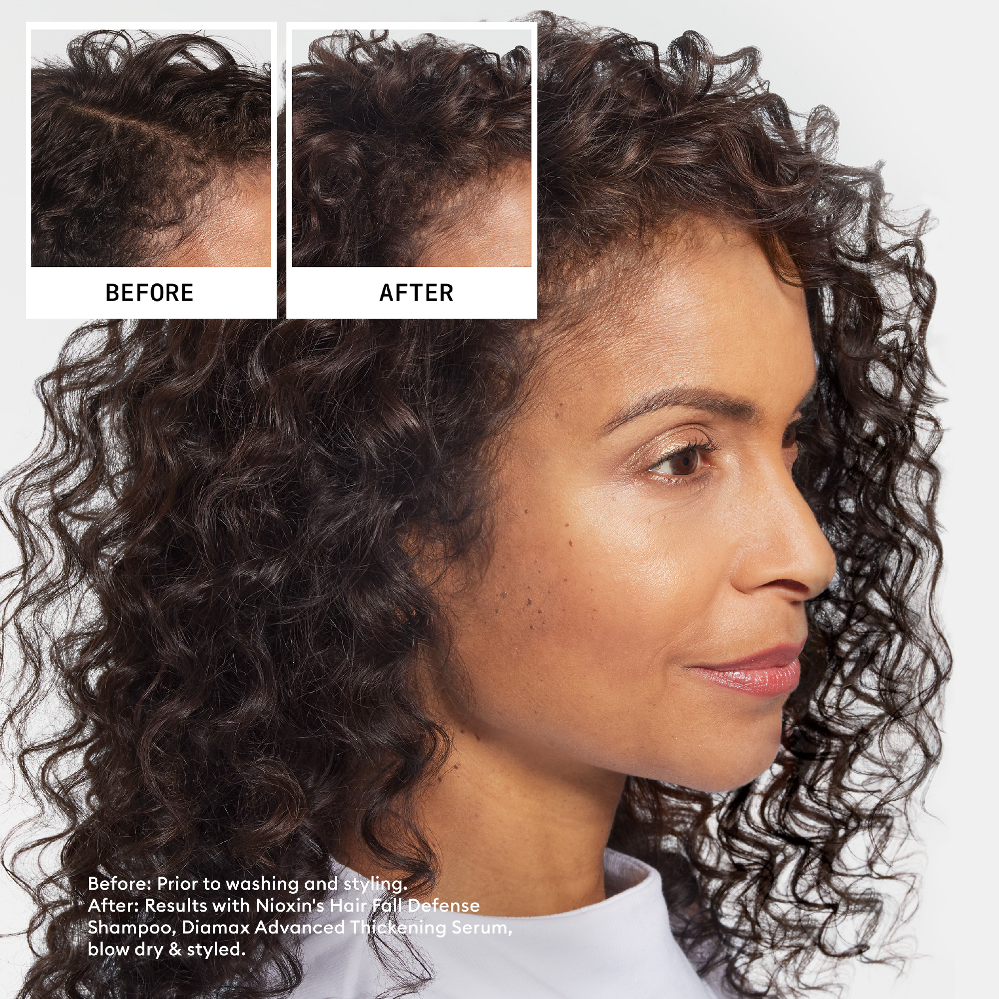 Nioxin Hair Fall Defense Shampoo 240ml