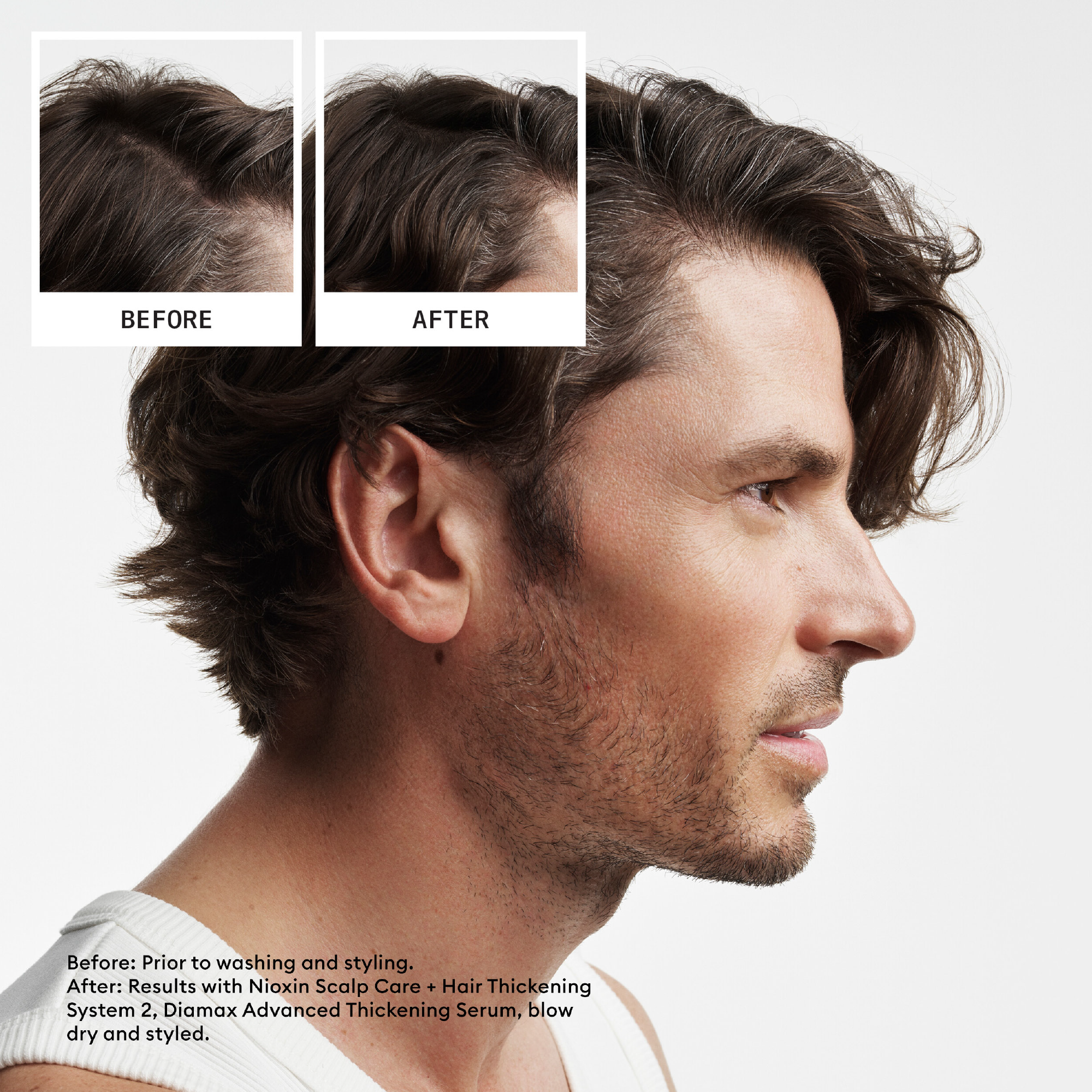 Nioxin System 2 Scalp + Hair Thickening Shampoo For Natural Hair with Progressed Thinning 300ml