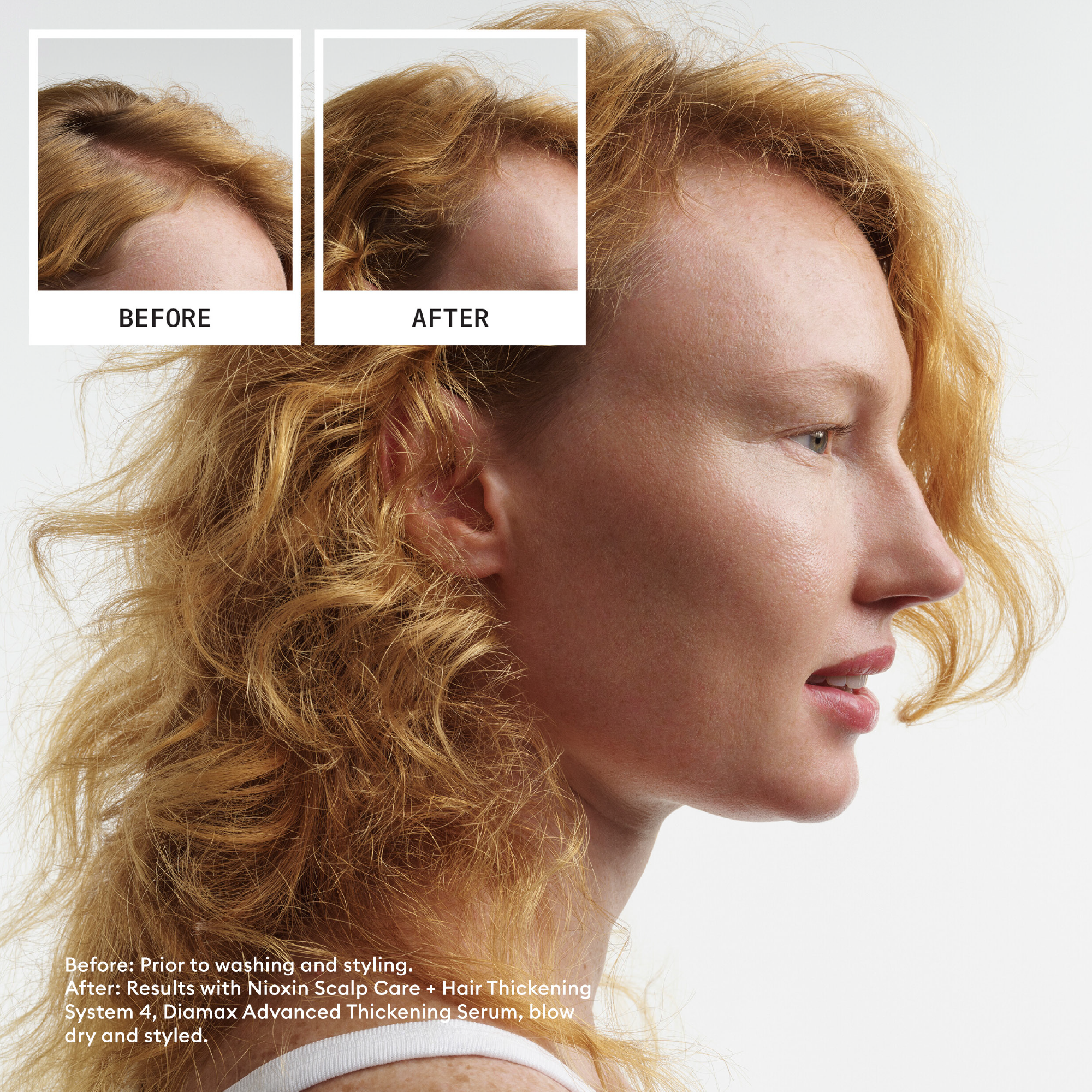 Nioxin System 4 Scalp + Hair Thickening Conditioner for Damaged Hair With Progressed Thinning 1 Litre